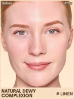 تینت پوست هک شیگلم - Image 4